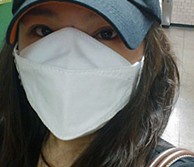 假体隆鼻手术过程及恢复效果图
