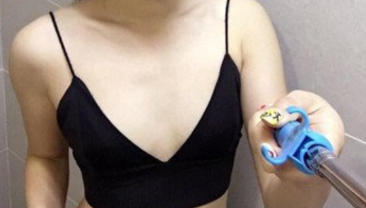 上海九院李伟胸部整形门诊时间表_自体隆胸+腿部吸脂_多少钱
