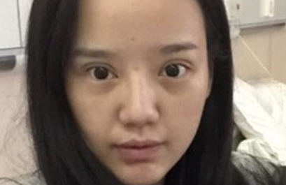 上海九院韦敏鼻综合+面部填充_门诊预约挂号_案例效果