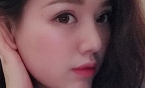 上海九院韦敏鼻综合+面部填充_门诊预约挂号_案例效果