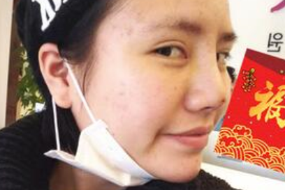 上海九院戴传昌做鼻子怎么样_真人效果案例_门诊挂号时间