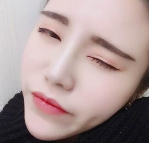 上海九院戴传昌做鼻子怎么样_真人效果案例_门诊挂号时间
