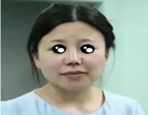 上海九院韦敏擅长做鼻子吗，做鼻子怎么样？鼻综合价格？隆鼻案例？