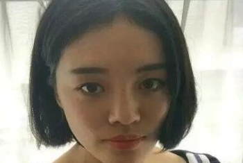 上海九院祝联做自体脂肪全脸填充怎么样_案例效果对比_价格