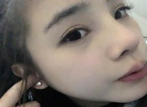 上海九院戴传昌鼻综合效果怎么样？做隆鼻价格多少钱？