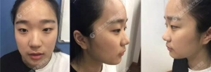上海华美眼综合鼻综合怎么样？好不好？有没有案例效果图啊？