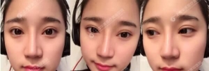 上海华美眼综合鼻综合怎么样？好不好？有没有案例效果图啊？
