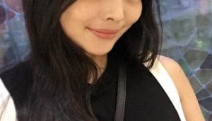 上海九院余庆雄面吸好不好_九院面部吸脂案例效果_吸脂价格