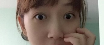 上海九院胡晓洁做双眼皮怎么样_眼综合案例效果_坐诊时间_价格