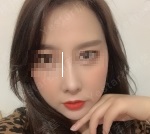 杭州艺星徐利刚做鼻子好吗？鼻修复呢？效果怎么样？