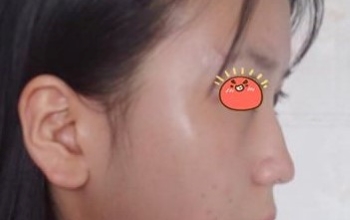 杭州美莱整形美容医院怎么样/正规吗_专家团队_案例_地址_评价