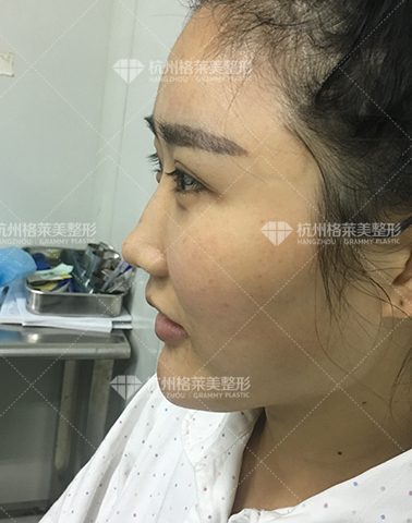 杭州格莱美怎么样？口碑好不好？正不正规?靠不靠谱?整形会失败吗?
