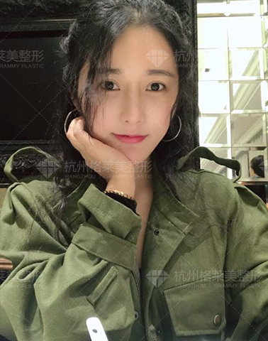 杭州格莱美怎么样？口碑好不好？正不正规?靠不靠谱?整形会失败吗?