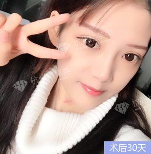 杭州格莱美怎么样？口碑好不好？正不正规?靠不靠谱?整形会失败吗?