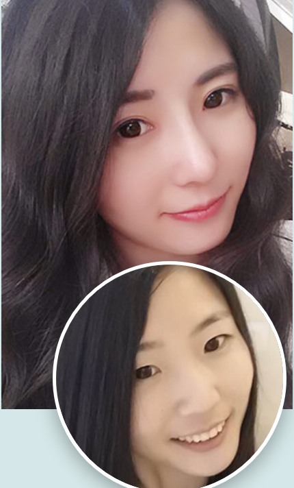 上海华美双眼皮哪个医生好？华美张朋双眼皮，开眼角怎么样？