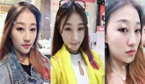 上海华美激光祛斑怎么样_华美祛斑价格表2019_激光祛斑专家_真人案例效果
