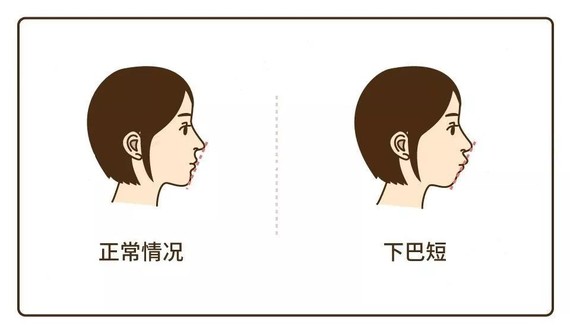 十年前的“阿奴”艳压群芳，十年后为何落得这般模样