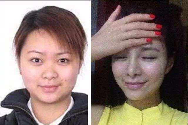 沈梦辰口中惊现“垫下巴白色假体”，整形传闻不攻自破？