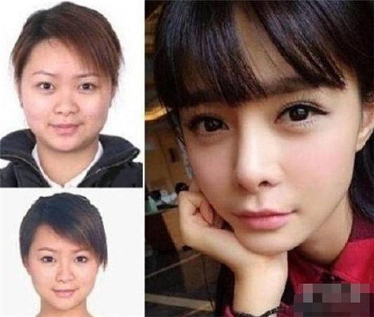 沈梦辰口中惊现“垫下巴白色假体”，整形传闻不攻自破？