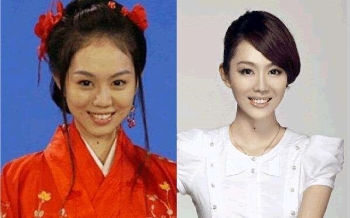 姜妍深陷整容风波，鼻子下巴都有动刀痕迹?