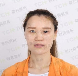 杭州时光黄良飞做隆鼻怎么样?杭州时光整形黄良飞是院长吗?