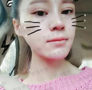 杭州时光黄良飞做隆鼻怎么样?杭州时光整形黄良飞是院长吗?