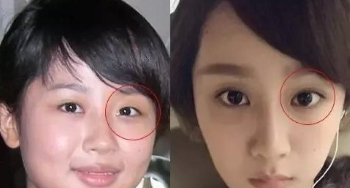 杨紫鼻子是假体吗|杨紫猛戳鼻子疑似回应整容传闻