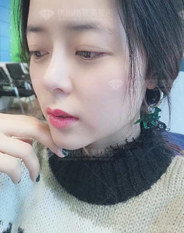 「汪云锋」杭州艺星Yestar汪云锋口碑怎么样-简介-擅长-评价-案例