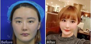 孙荣从上海九院离职到上海薇琳的原因是什么?是不是因为整形技术太垃圾了?