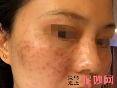 广州军区总医院激光整形中心怎么样?医生推荐,附带案例详情