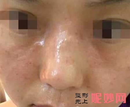 广州军区总医院激光整形中心怎么样?医生推荐,附带案例详情
