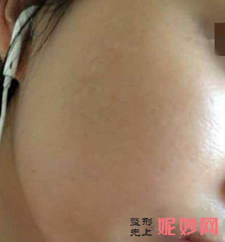 广州军区总医院激光整形中心怎么样?医生推荐,附带案例详情