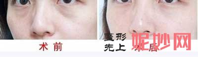 听说重庆军科整形林勇医生做脂肪填充口碑不错，收费如何