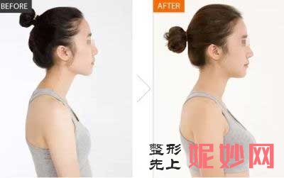 重庆军科整形医疗美容赵亚均如何?口碑好吗?