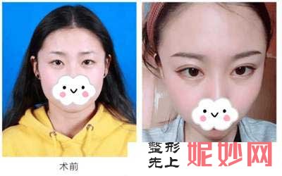 重庆艺星医疗美容医院朱家旭医生如何?口碑好不好?