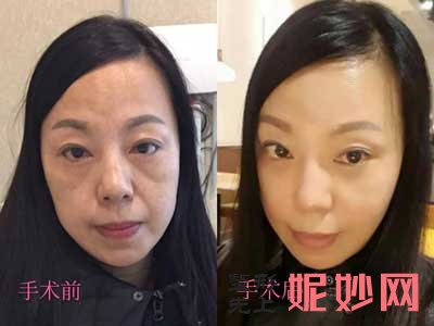郑州辰星医疗美容医院何清磊技术好不好?医生介绍,擅长项目,案例,价格