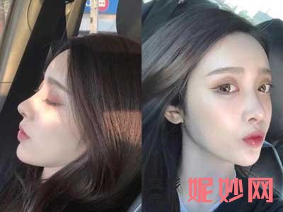 郑州辰星医疗美容医院常玉杰微整形技术怎样?擅长项目,个人介绍,案例
