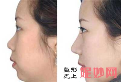 温州粉范医疗整形美容苑庆日医生整形技术好吗?口碑怎么样?案例分享