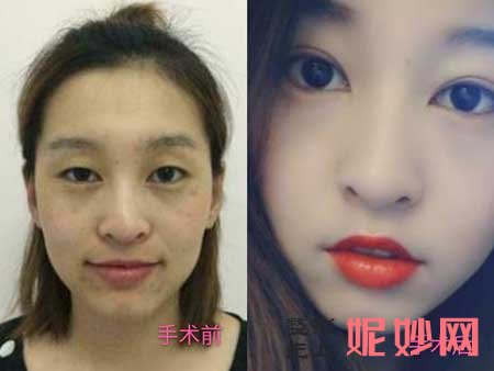 郑州东方整形美容医院贺洁整形技术怎么样?擅长项目,案例分享