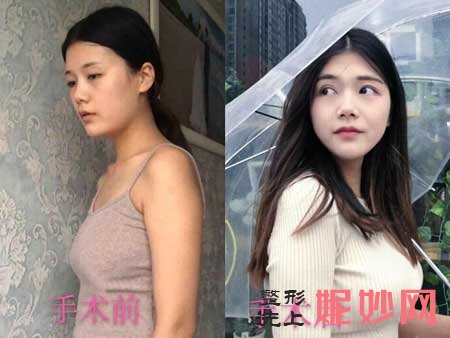 郑州天美医疗美容匡海龙整形技术好不好?擅长项目,案例分享