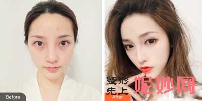 西安西京医院整形科崔江波医生技术好不好?擅长项目_案例_术后评价_出诊时间