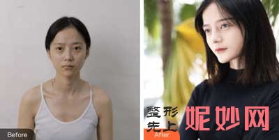 西安西京医院整形科崔江波医生技术好不好?擅长项目_案例_术后评价_出诊时间