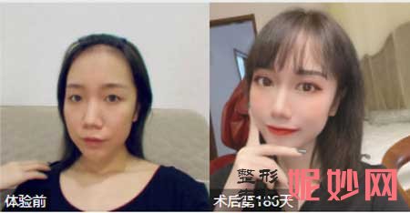 西京医院整形科孙峰医生好不好?擅长项目_案例_预约挂号/电话_门诊时间
