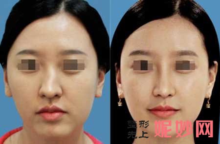 西京医院整形科孙峰医生好不好?擅长项目_案例_预约挂号/电话_门诊时间