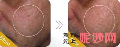 西京医院整形外科李荟元医生好不好?个人资料_案例_出诊时间/预约时间