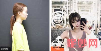 西京医院整形科李杨医生怎么样?个人资料_案例_出诊时间/预约门诊