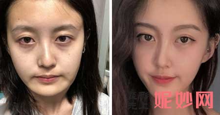 西京医院整形外科彭湃医生好不好?擅长项目_案例_出诊时间/预约门诊