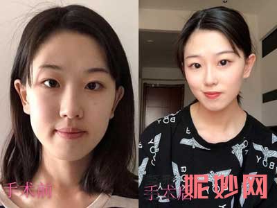西京医院整形外科夏文森医生怎么样?好不好?擅长项目_案例_出诊时间/预约门诊