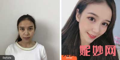 西京医院整形外科夏文森医生怎么样?好不好?擅长项目_案例_出诊时间/预约门诊