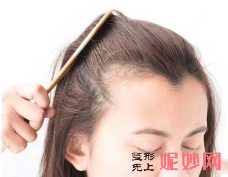 【薛萍】西安西京医院薛萍医生做发际线种植怎么样?案例_费用_出诊时间